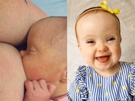 down syndrome tits|Breastfeeding Your Baby With Down Syndrome